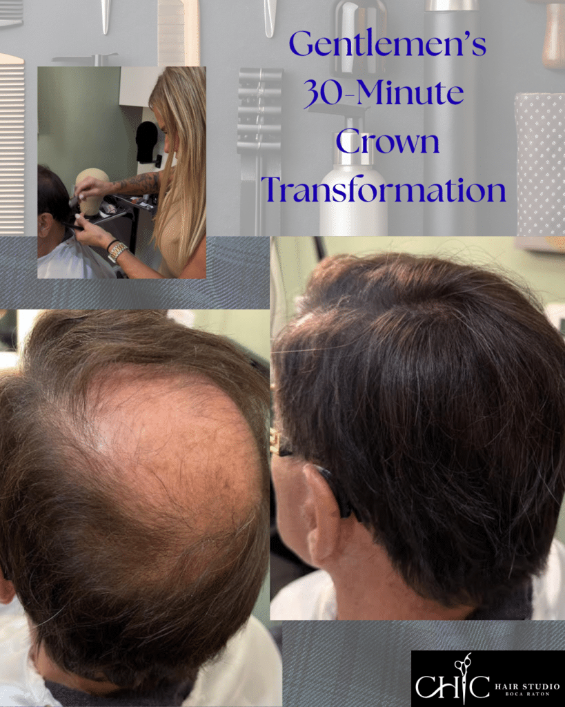men's hair replacement solutions