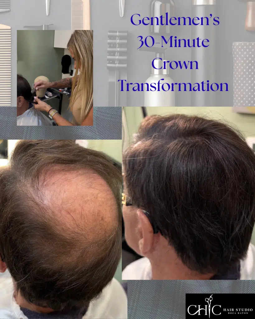 men's hair replacement solutions