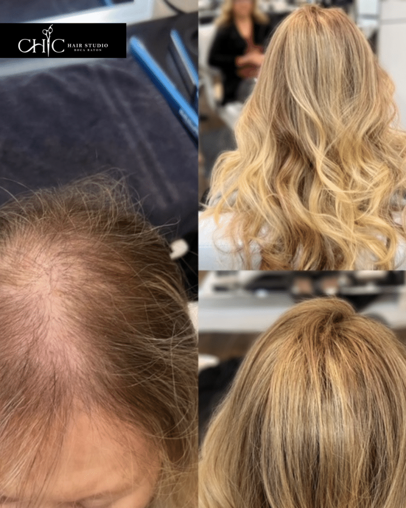 women's hair replacement solutions