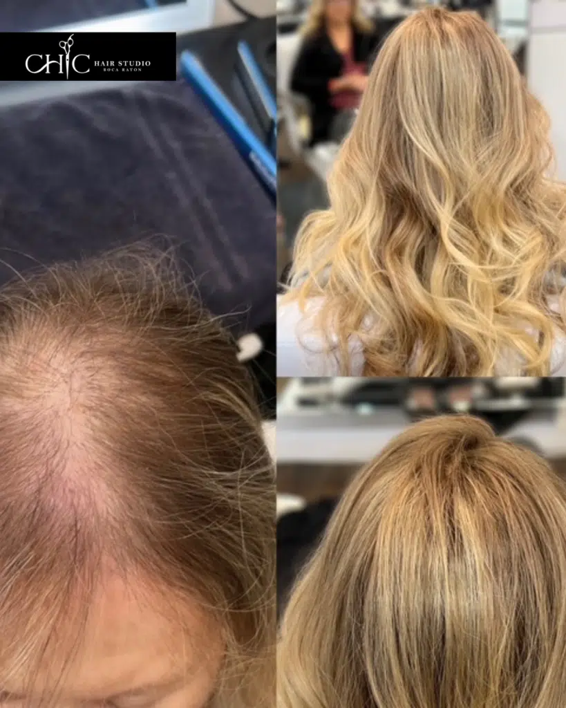 women's hair replacement solutions